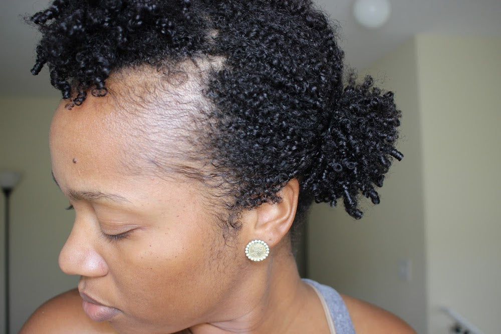 Postpartum Hair Shed: Why It Occurs & What To Do About It Holistically